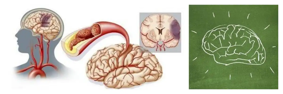 product-1-1 product-1-1