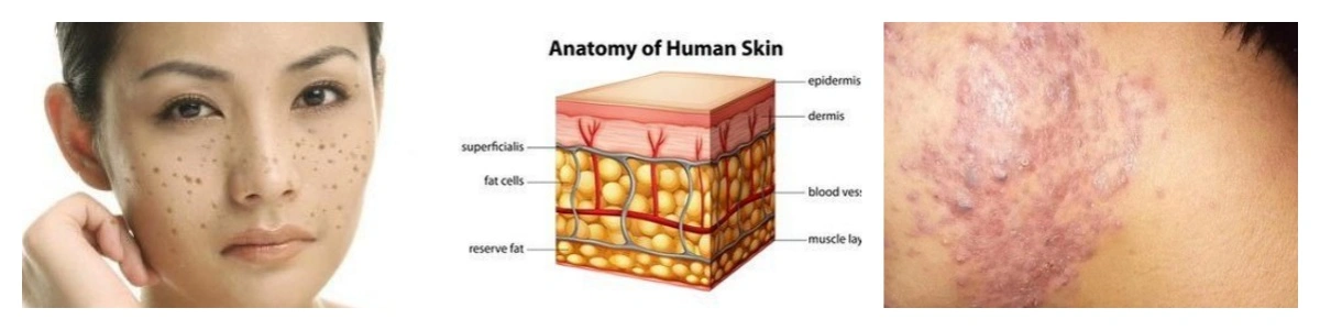 product-1-1 product-1-1