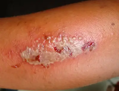 blog-400-306 blog-400-306