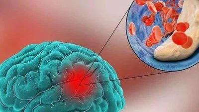 blog-400-225 blog-400-225