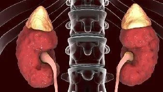 blog-337-190 blog-337-190