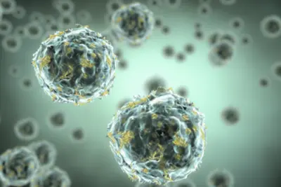 blog-400-267 blog-400-267