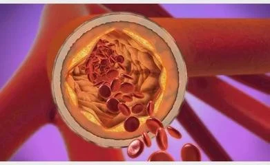 blog-391-240 blog-391-240