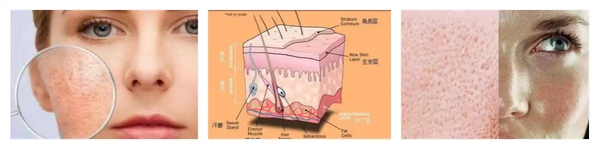 blog-1-1