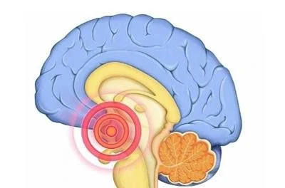 blog-400-264 blog-400-264